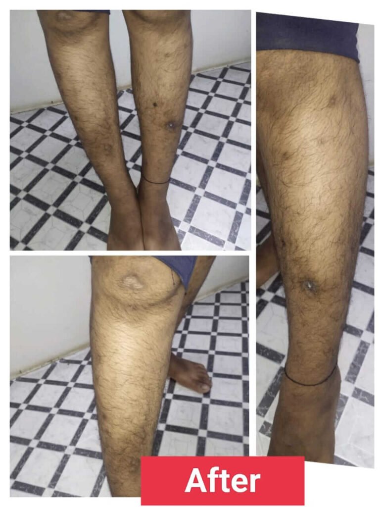 before after result