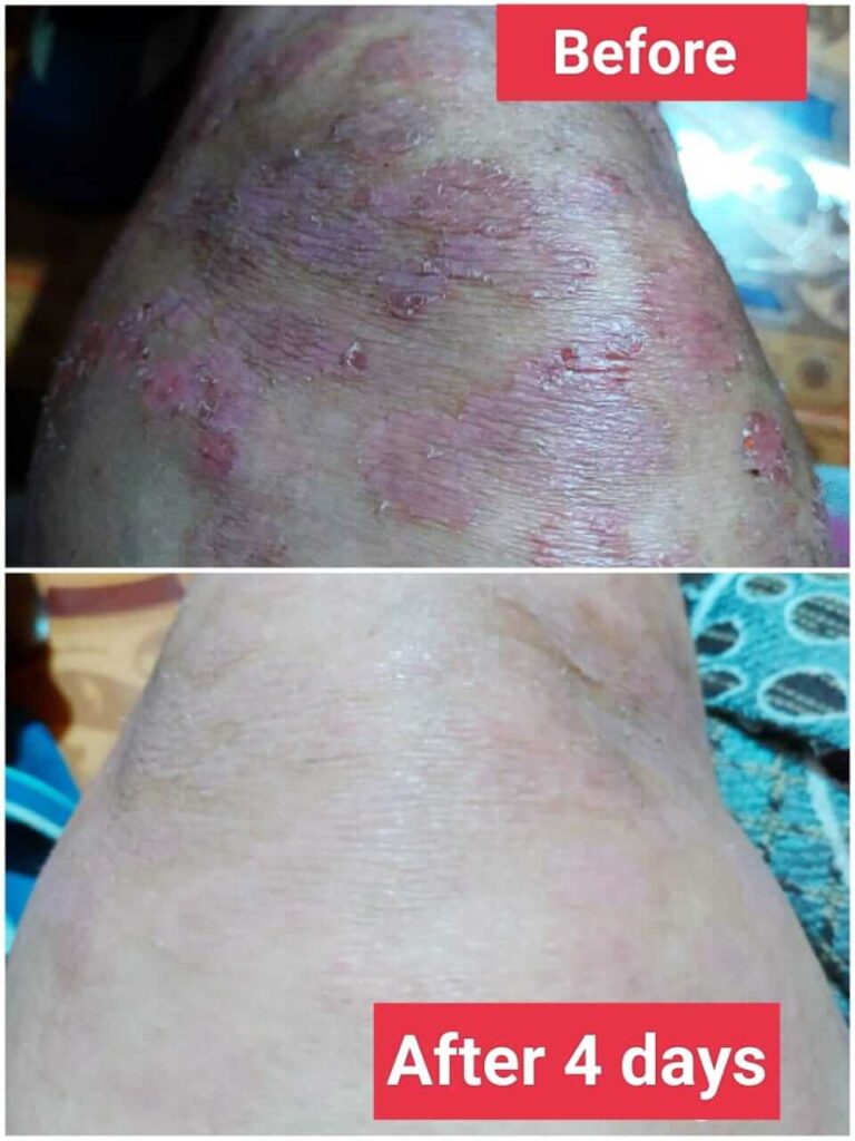 https://miraclehomoeopathy.com/results/
