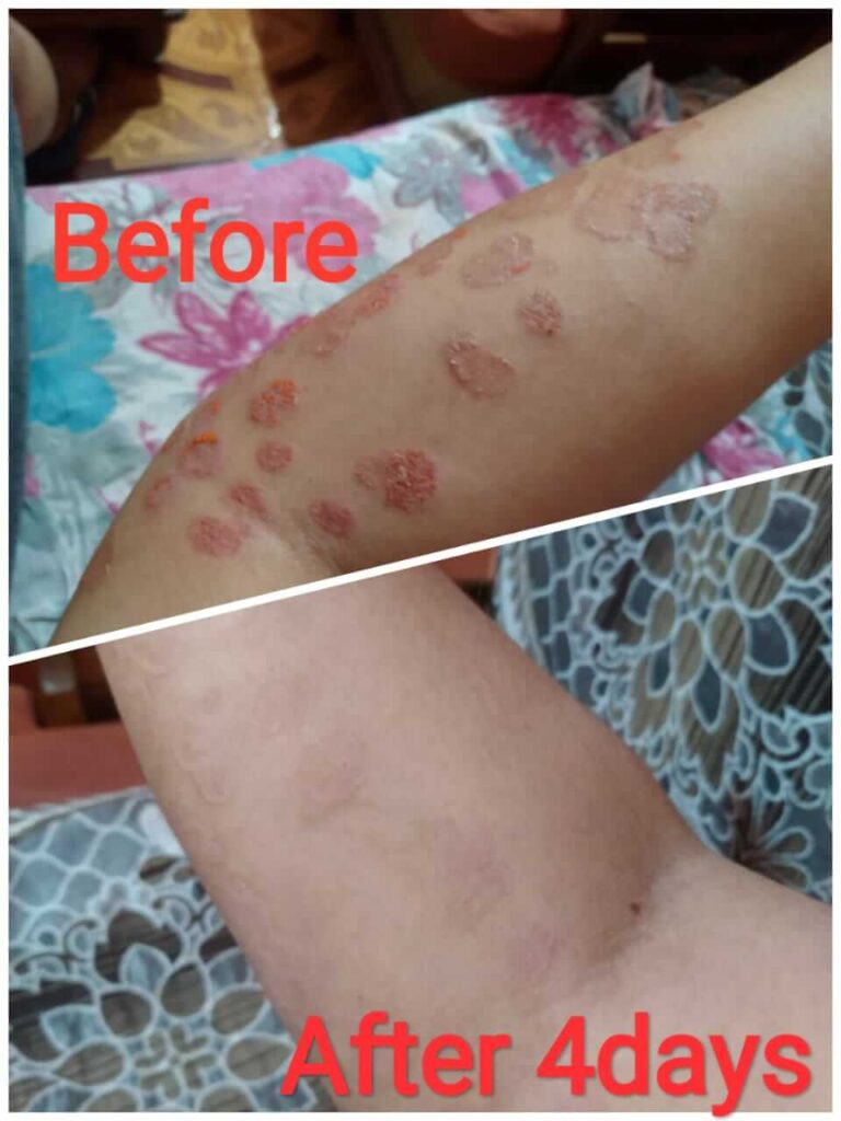 https://miraclehomoeopathy.com/results/